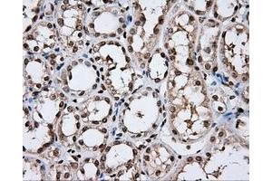 Immunohistochemical staining of paraffin-embedded lung tissue using anti-DAPK2 mouse monoclonal antibody. (DAPK2 Antikörper)