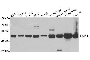 Western blot analysis of extracts of various cell lines, using HADHB antibody.