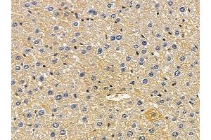 ABIN6258498 and ABIN6274470 at 1/100 staining mouse liver tissue by IHC-P. (ORCTL-2/SLC22A18 Antikörper  (C-Term))