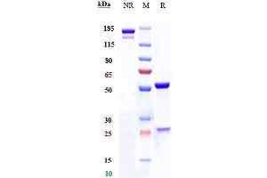 Anti-NOTCH1 Reference Antibody (brontictuzumab) on SDS-PAGE under reducing (R) condition.