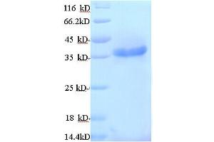 SDS-PAGE (SDS) image for Ribokinase (RBKS) (AA 1-309), (full length) protein (His tag) (ABIN5713184)