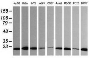 Image no. 2 for anti-HRas proto-oncogene, GTPase (HRAS) antibody (ABIN1498714) (HRAS Antikörper)