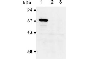 Western Blotting (WB) image for anti-Checkpoint Kinase 2 (CHEK2) antibody (ABIN487488) (CHEK2 Antikörper)