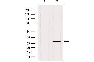 Western blot analysis of extracts from 3t3, using PHF19 Antibody. (PHF19 Antikörper  (Internal Region))