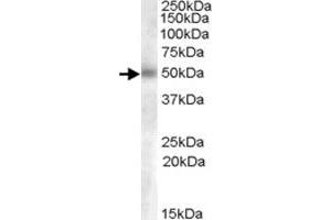 GCNT3 polyclonal antibody  (0. (GCNT3 Antikörper  (AA 273-284))