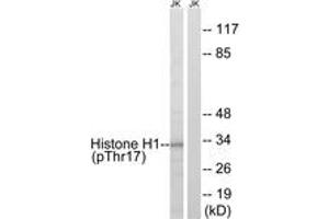Western blot analysis of extracts from Jurkat cells treated with UV 15', using Histone H1 (Phospho-Thr17) Antibody. (Histone H1 Antikörper  (pSer17))