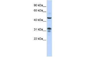 WB Suggested Anti-ZNF765 Antibody Titration:  0. (ZNF765 Antikörper  (N-Term))