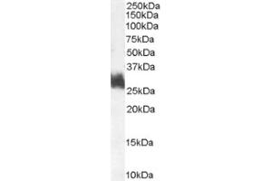 Image no. 1 for anti-FOS-Like Antigen 1 (FOSL1) (Internal Region) antibody (ABIN374695) (FOSL1 Antikörper  (Internal Region))