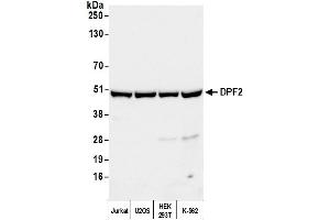 Western Blotting (WB) image for anti-Zinc finger protein ubi-d4 (DPF2) (AA 125-175) antibody (ABIN7451434) (DPF2 Antikörper  (AA 125-175))