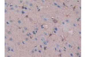 IHC-P analysis of Mouse Cerebrum Tissue, with DAB staining. (SLIT1 Antikörper  (AA 3-211))