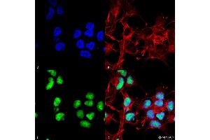 Immunocytochemistry/Immunofluorescence analysis using Rabbit Anti-Choline Acetyltransferase Polyclonal Antibody . (Choline Acetyltransferase Antikörper  (N-Term) (APC))