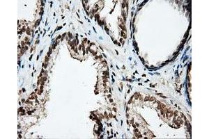 Immunohistochemistry (IHC) image for anti-Protein tyrosine Phosphatase, Receptor Type, E (PTPRE) antibody (ABIN2730137)