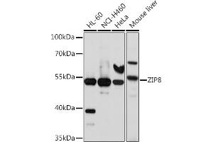 Western blot analysis of extracts of various cell lines, using ZIP8 antibody (ABIN6131079, ABIN6147995, ABIN6147996 and ABIN6214638) at 1:1000 dilution. (SLC39A8 Antikörper  (AA 180-300))