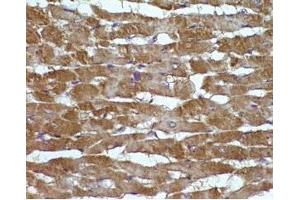 Rat hearttissue was stained by Angiotensin II (1-7) (Human) at 1:100 (AGT Antikörper  (AA 1-7))