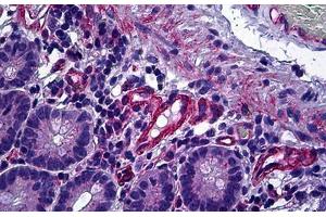 Immunohistochemistry (IHC) image for anti-Protein Phosphatase 3, Catalytic Subunit, alpha Isoform (PPP3CA) (AA 21-51) antibody (ABIN1804070)