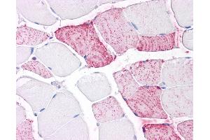 Anti-PTPRA antibody IHC of human skeletal muscle. (PTPRA Antikörper  (Extracellular Domain))