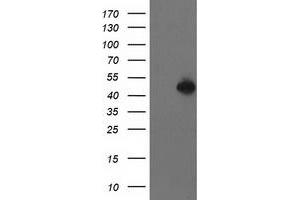 Western Blotting (WB) image for anti-Pre-B-Cell Leukemia Homeobox Protein 1 (PBX1) antibody (ABIN1500046) (PBX1 Antikörper)