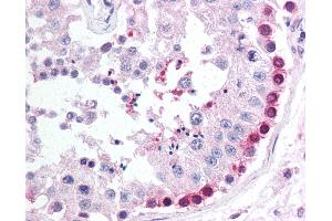 Anti-PINK1 antibody IHC of human testis. (PINK1 Antikörper  (AA 484-504))