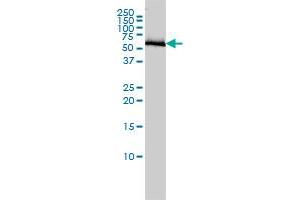 COASY monoclonal antibody (M01), clone 1H6 Western Blot analysis of COASY expression in A-431 . (COASY Antikörper  (AA 1-225))