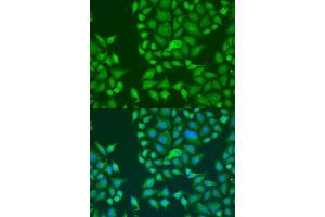 Immunofluorescence analysis of U2OS cells using ST antibody  at dilution of 1:100. (Double-stranded RNA-binding protein Staufen homolog 2 (STAU2) (AA 300-400) Antikörper)