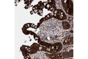 Immunohistochemical staining of human colon with GARNL4 polyclonal antibody  shows strong cytoplasmic, membranous and nuclear positivity in glandular cells at 1:50-1:200 dilution.