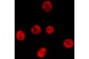 ABIN6277190 staining HepG2 by IF/ICC. (USP7 Antikörper  (Internal Region))