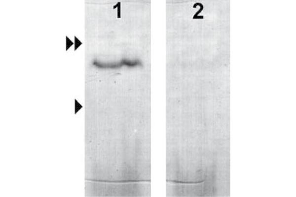 GUCA2B antibody