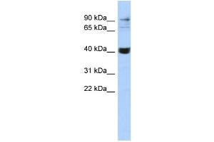 WB Suggested Anti-MMP3 Antibody Titration:  0. (MMP3 Antikörper  (Middle Region))