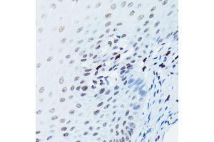 Immunohistochemistry (IHC) image for anti-Histone H2A (pSer139) antibody (ABIN6136140)