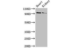 Western Blot Positive WB detected in: Mouse heart tissue, Mouse kidney tissue All lanes: VPS39 antibody at 3 μg/mL Secondary Goat polyclonal to rabbit IgG at 1/50000 dilution Predicted band size: 102, 101 kDa Observed band size: 102 kDa (VPS39 Antikörper  (AA 263-490))
