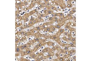 Immunohistochemistry of paraffin-embedded human liver using GFR Rabbit pAb (ABIN6127950, ABIN6141065, ABIN6141066 and ABIN6221017) at dilution of 1:100 (40x lens). (GFRA1 Antikörper  (AA 25-280))