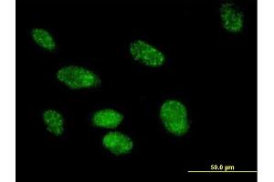 Immunofluorescence of purified MaxPab antibody to FKBP3 on HeLa cell.