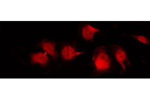 ABIN6269008 staining Hela by IF/ICC. (GLUT1 Antikörper  (C-Term))