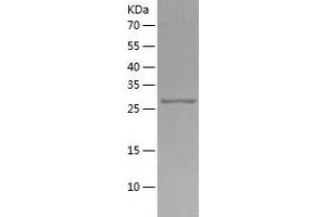 Western Blotting (WB) image for Secreted Protein, Acidic, Cysteine-Rich (Osteonectin) (SPARC) (AA 18-297) protein (His tag) (ABIN7285197) (SPARC Protein (AA 18-297) (His tag))