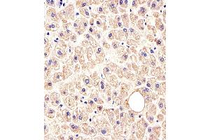 Immunohistochemical analysis of paraffin-embedded H. (c-MET Antikörper  (Catalytic Domain))