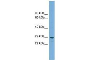 Image no. 1 for anti-C-Type Lectin Domain Family 4, Member M (CLEC4M) (AA 143-192) antibody (ABIN6745594)