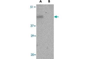 Western blot analysis of PDCD1 in THP-1 cell lysate with PDCD1 polyclonal antibody  at 1 ug/mL in the (A) absence and (B) presence of blocking peptide. (PD-1 Antikörper  (Internal Region))