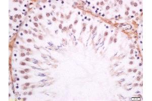 Paraformaldehyde-fixed, paraffin embedded rat testis tissue, Antigen retrieval by boiling in sodium citrate buffer(pH6) for 15min, Block endogenous peroxidase by 3% hydrogen peroxide for 30 minutes, Blocking buffer (normal goat serum) at 37°C for 20min, Antibody incubation with Rabbit Anti-DMO/Dmrt1a Polyclonal Antibody, Unconjugated  at 1:200 overnight at 4°C, followed by a conjugated secondary and DAB staining (DMO/Dmrt1a (AA 51-100) Antikörper)