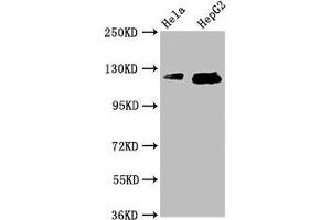 Western Blot Positive WB detected in: Hela whole cell lysate, HepG2 whole cell lysate All lanes: TMF1 antibody at 3. (TMF1 Antikörper  (AA 878-986))