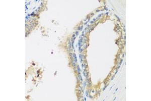Immunohistochemistry of paraffin-embedded human prostate using WDR77 antibody at dilution of 1:200 (40x lens). (WDR77 Antikörper)