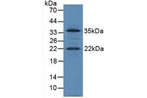 IGF1 anticorps  (AA 49-153)