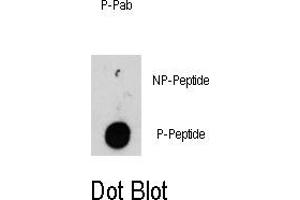 Image no. 1 for anti-Integrin-Linked Kinase (ILK) (pThr173) antibody (ABIN358419) (ILK Antikörper  (pThr173))
