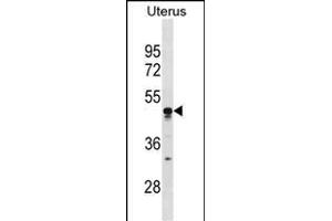 TIMD4 Antibody (C-term) (ABIN1881886 and ABIN2838417) western blot analysis in human Uterus tissue lysates (35 μg/lane). (TIMD4 Antikörper  (C-Term))