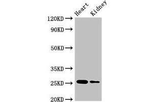 Western Blot Positive WB detected in: Mouse heart tissue, Mouse kidney tissue All lanes: CSH2 antibody at 4 μg/mL Secondary Goat polyclonal to rabbit IgG at 1/50000 dilution Predicted band size: 25, 19, 14 kDa Observed band size: 25 kDa (CSH1 Antikörper  (AA 27-217))