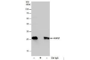 IP Image Immunoprecipitation of HSP27 protein from HeLa whole cell extracts using 5 μg of HSP27 antibody, Western blot analysis was performed using HSP27 antibody, EasyBlot anti-Rabbit IgG  was used as a secondary reagent.