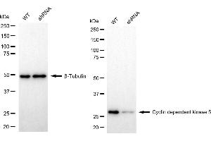 Western blotting analysis using cyclin dependent kinase 5 antibody (ABIN7798217). (Rekombinanter CDK5 Antikörper)