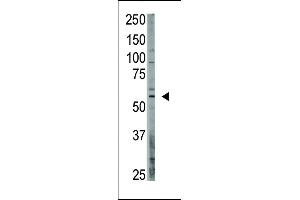 Antibody is used in Western blot to detect OASIS in A375 lysate. (CREB3L1 Antikörper  (C-Term))