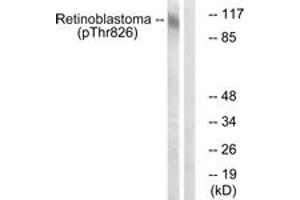 Western blot analysis of extracts from HepG2 cells treated with nocodazole 1ug/ml 16h, using Retinoblastoma (Phospho-Thr826) Antibody.