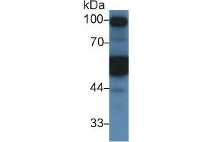 Detection of a1AT in Mouse Kidney lysate using Polyclonal Antibody to Alpha-1-Antitrypsin (a1AT) (SERPINA1 Antikörper  (AA 25-413))
