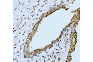 IHC analysis of SBNO1 using anti-SBNO1 antibody (ABIN7601710). (SBNO1 Antikörper  (AA 43-1303))